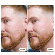 Charger l'image dans la galerie, Derma Roller : Rouleau Microaiguille capillaire