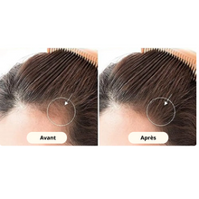 Charger l'image dans la galerie, Derma Roller : Rouleau Microaiguille capillaire